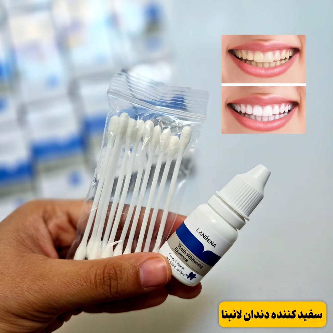 جرمگیر دندان لنبنا